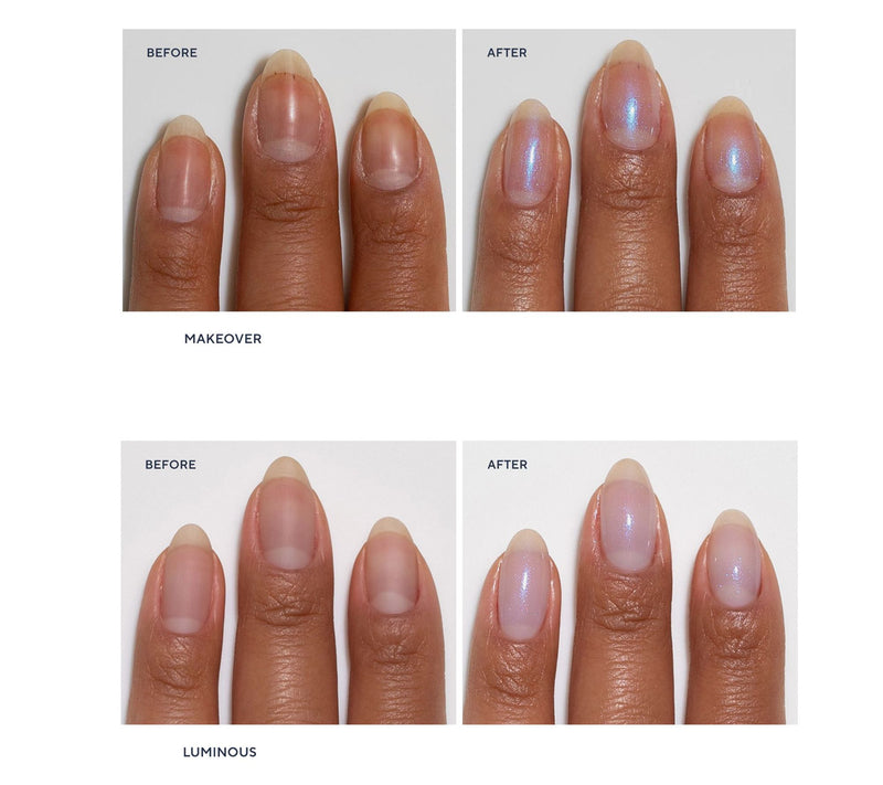 Dermelect Clean & Care Nail Renewal Kit — View 6