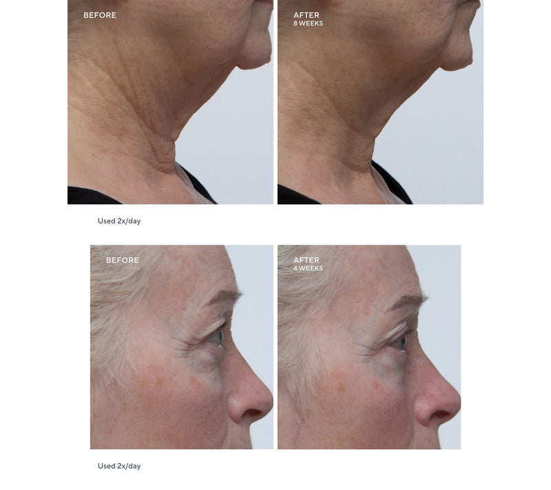 philosophy when hope is not enough serum 4oz duo — View 4