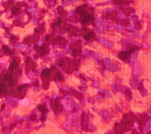 Belle by Kim Gravel Summer Sunset Cotton Gauze Tie Dye Henley — View 7