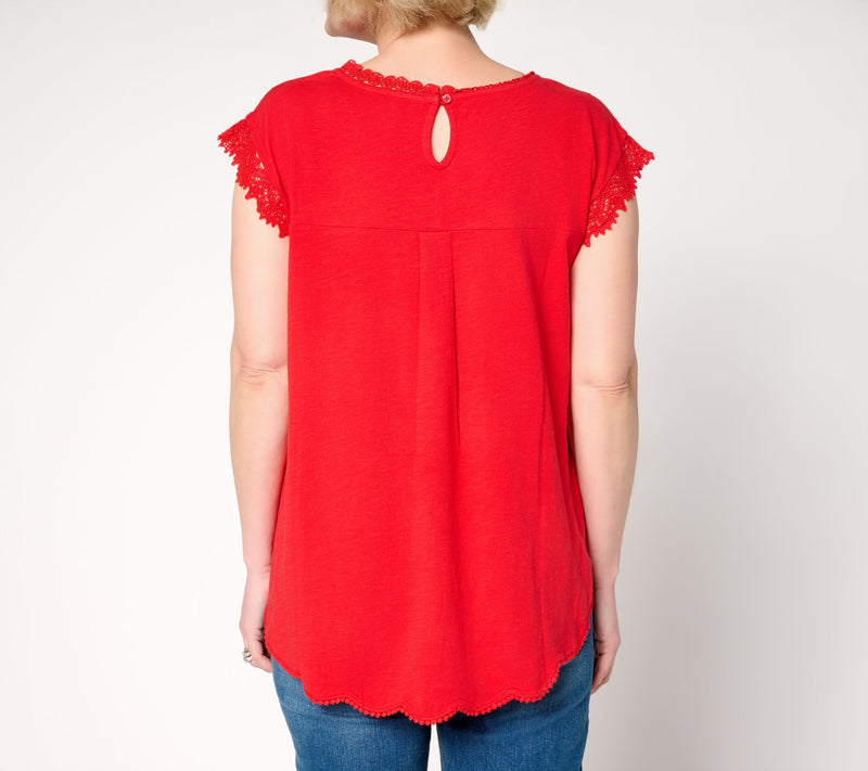LOGO Lavish by Lori Goldstein 100% Cotton Scallop Hem Top — View 10