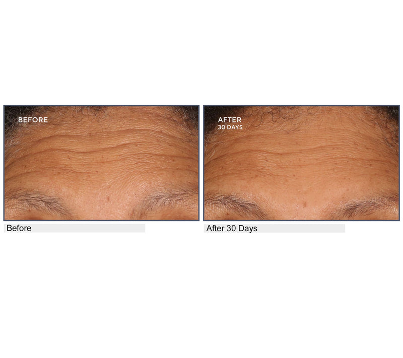 SERIOUS SKINCARE A-Defiance Retinol Serum, Cream, & Pads — View 5