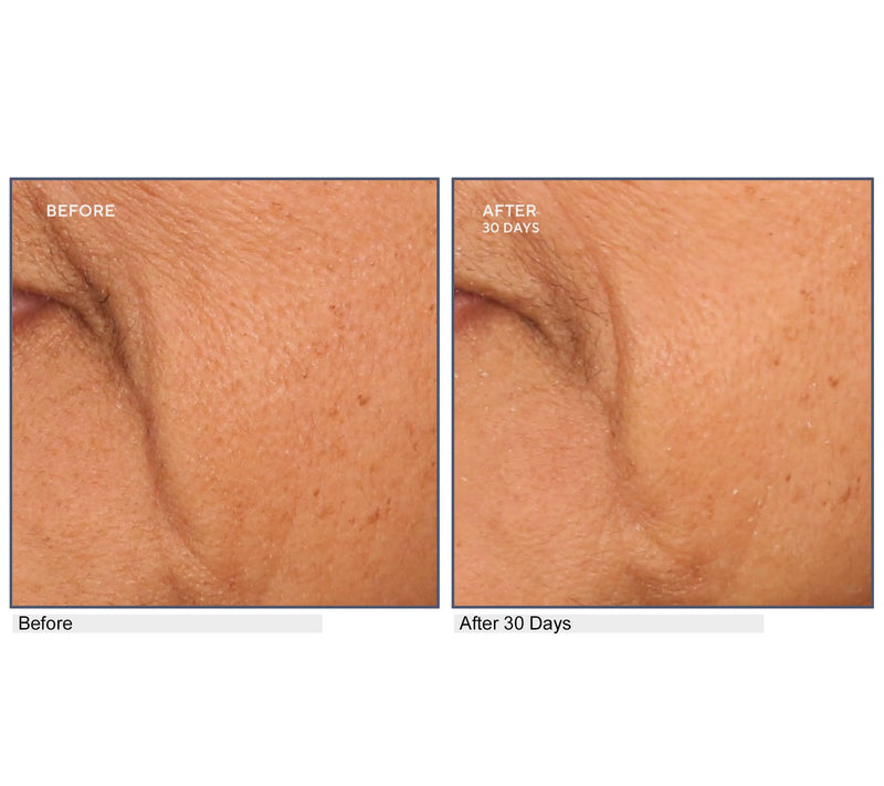 SERIOUS SKINCARE A-Defiance Retinol Serum, Cream, & Pads — View 6