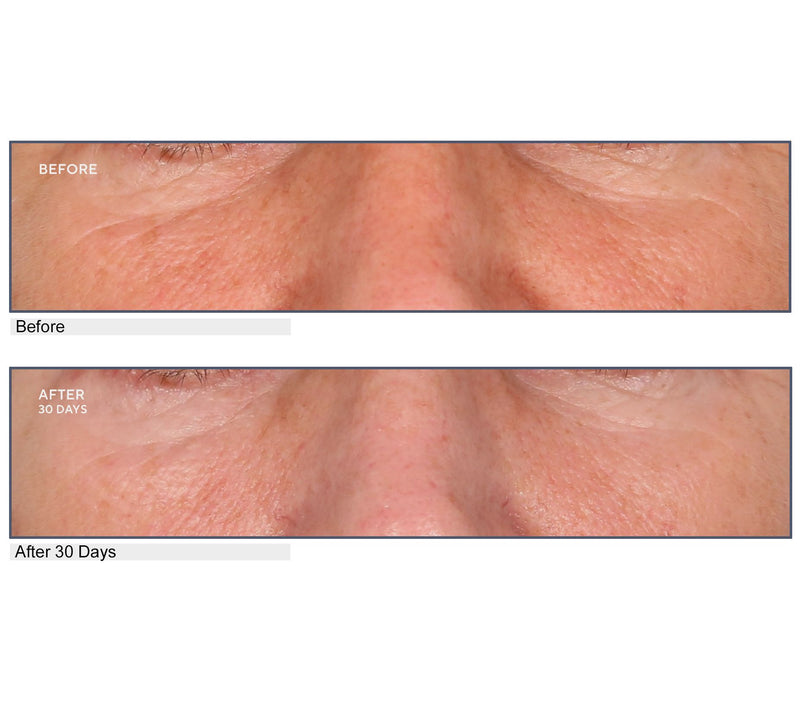 SERIOUS SKINCARE A-Defiance Retinol Serum, Cream, & Pads — View 3