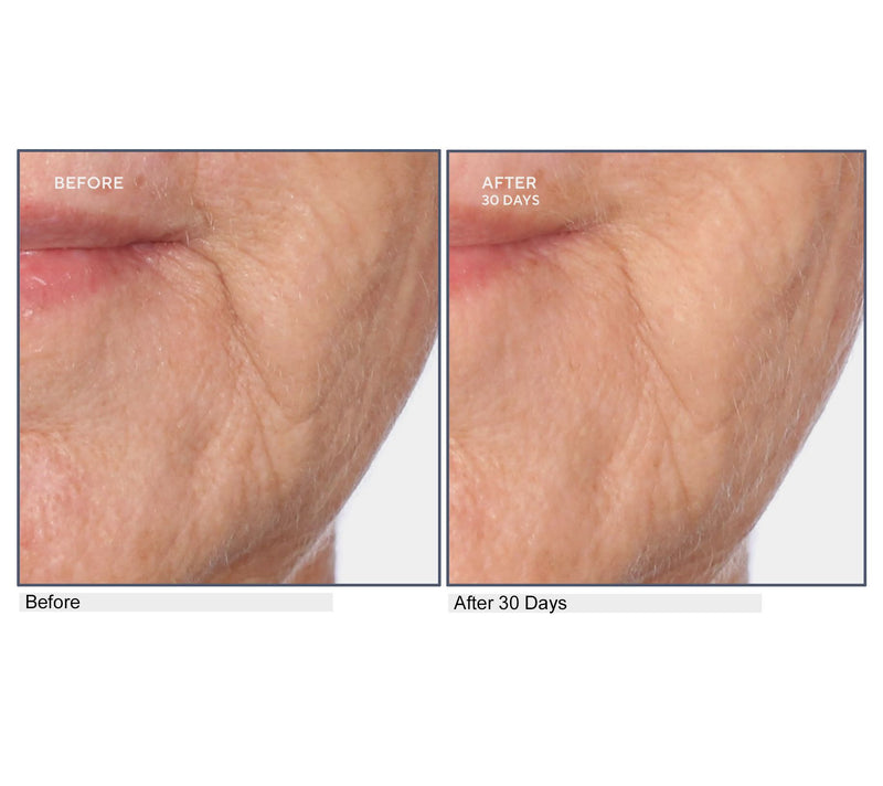 SERIOUS SKINCARE A-Defiance Retinol Serum, Cream, & Pads — View 4