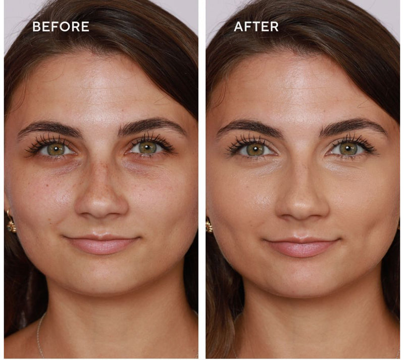 Doll 10 Doll Skin Genius Serum Concealer with Reishi Mushroom — View 25