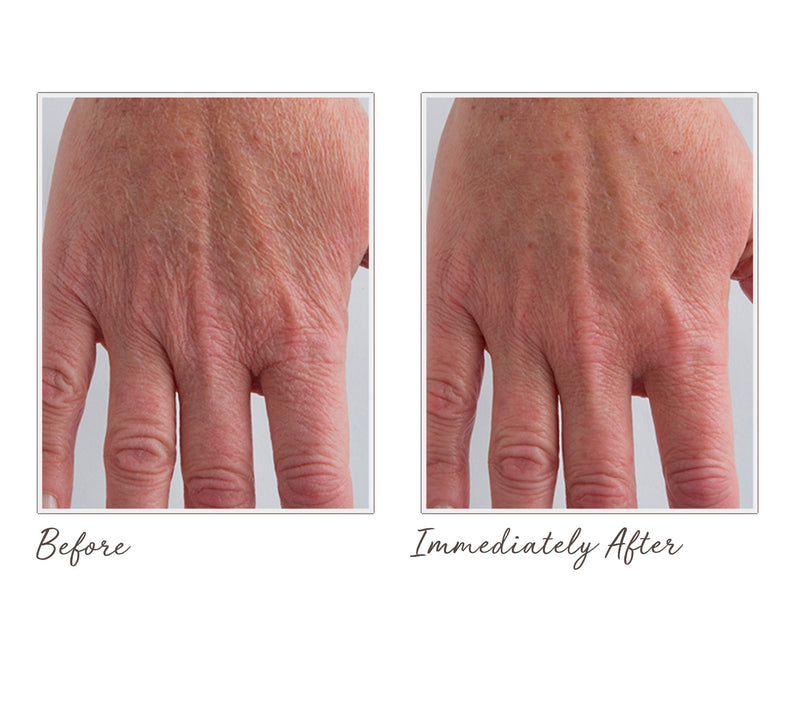 Crepe Erase Body Repair System w/ Body Resurfacing Serum — View 6