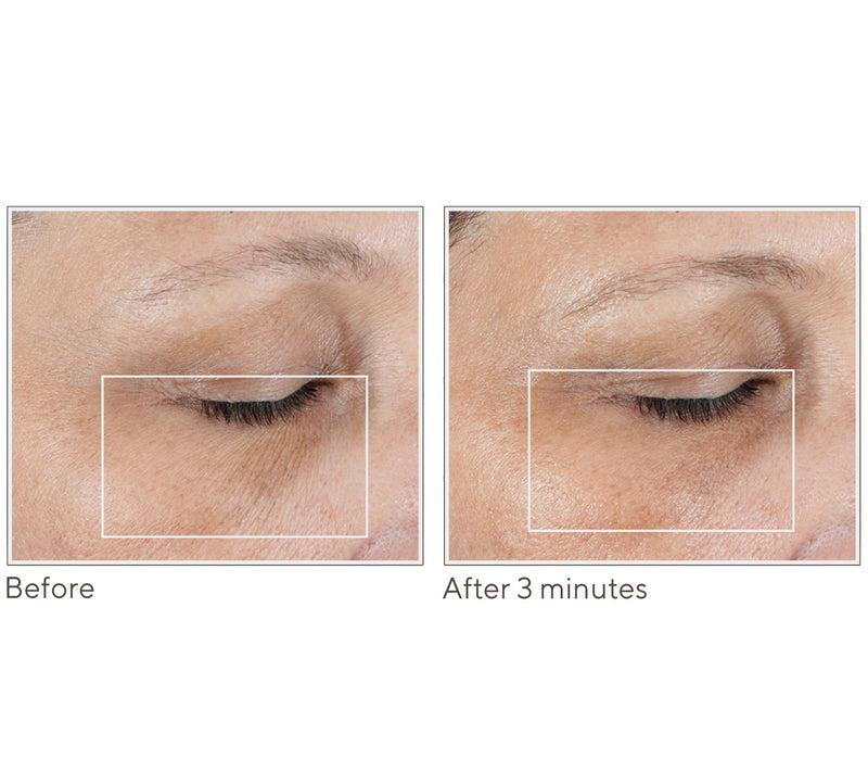NuFace FIX MicroWand w/Serum & Power Patches Set Auto-Delivery — View 8