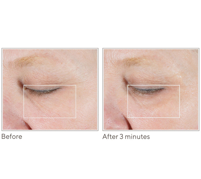 NuFace FIX MicroWand w/Serum & Power Patches Set Auto-Delivery — View 5