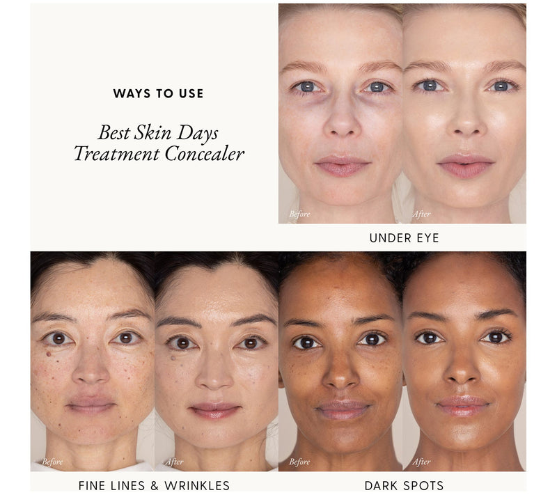 Iris & Romeo Best Skin Days Treatment Concealer — View 24