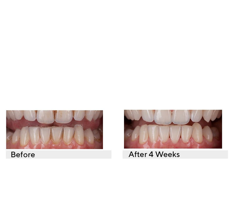 MINT Hollywood Smile Polishing Paste — View 6