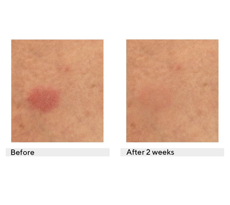 KAPLAN MD Diamond Contour Eczema + Dermatitis Skin Balm — View 2