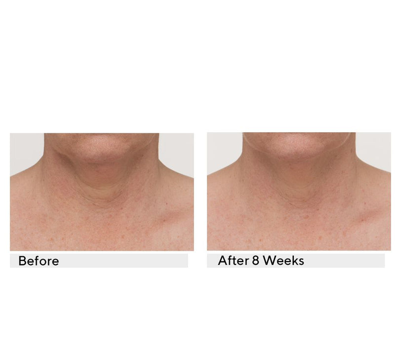 StriVectin TL Advanced Tightening Neck Plus Cream, 1 oz — View 4