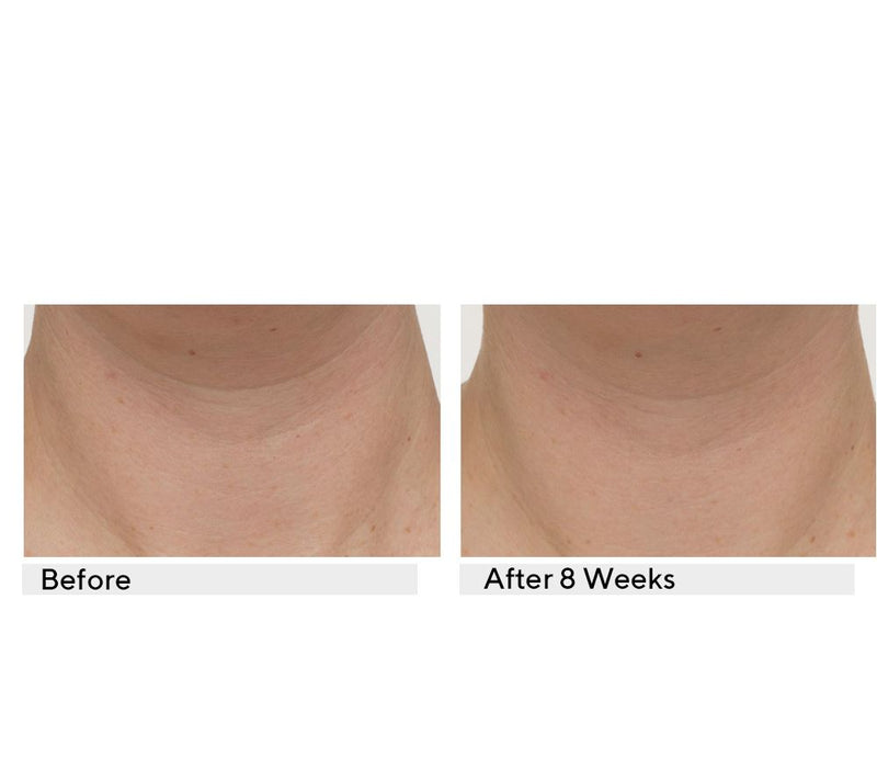 StriVectin TL Advanced Tightening Neck Plus Cream, 1 oz — View 7