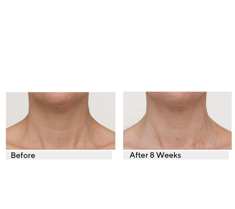 StriVectin TL Advanced Tightening Neck Plus Cream, 1 oz — View 6