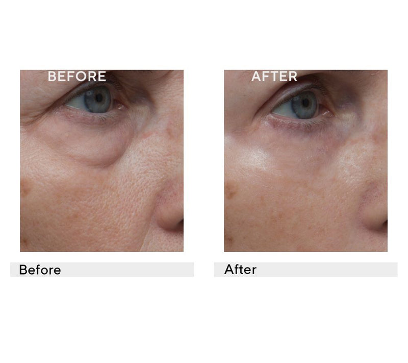 Dr. Denese Wrinkle Lost Line Reducer 1 oz — View 2