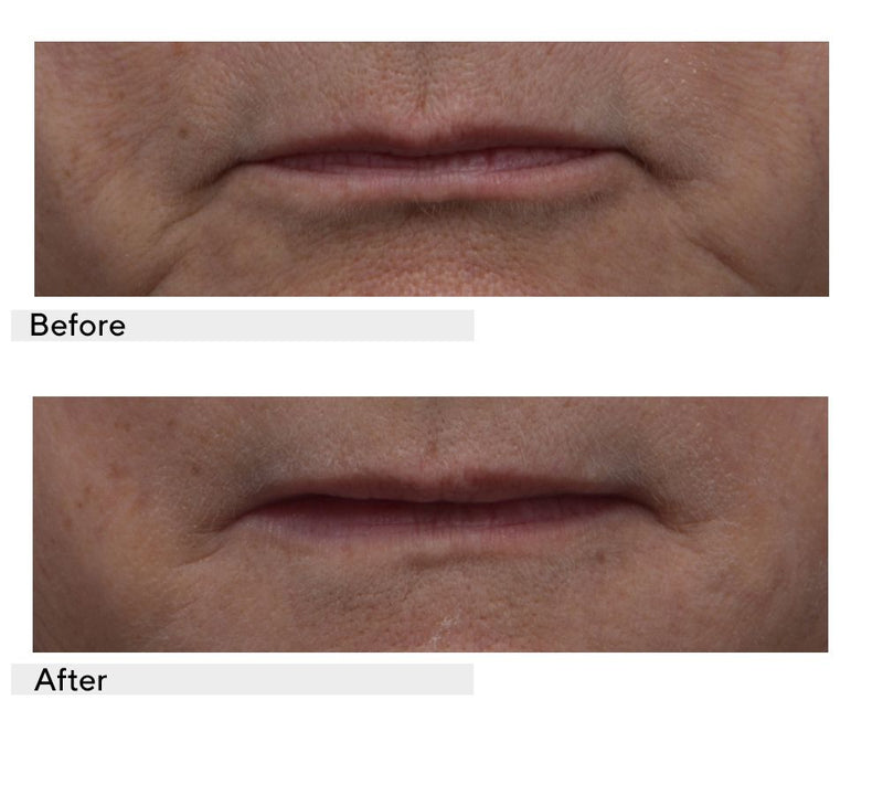Dr. Denese Wrinkle Lost Line Reducer 2 oz — View 4