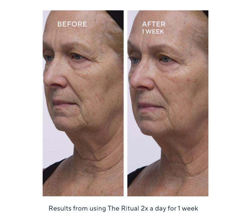 TATCHA 4-Piece Ritual For Bright and Renewed Skin — View 5