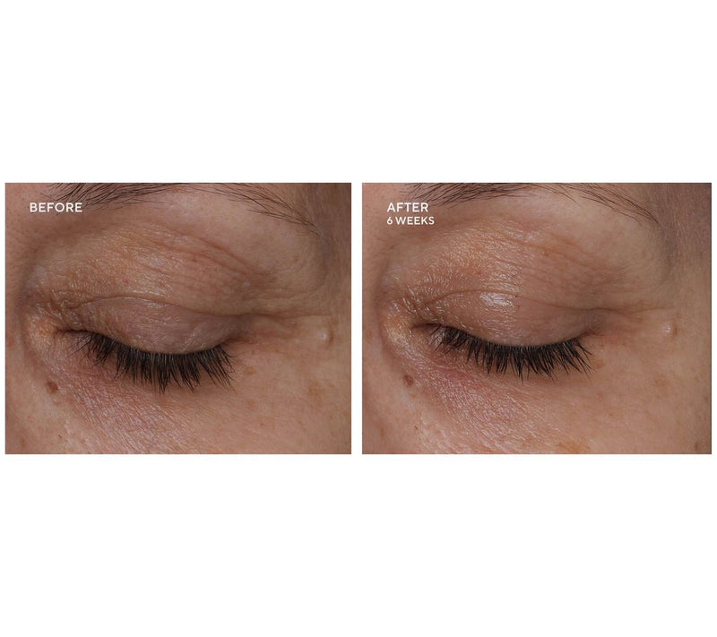 True Botanicals Pure Radiance Supreme Eye Cream 0.5oz — View 4