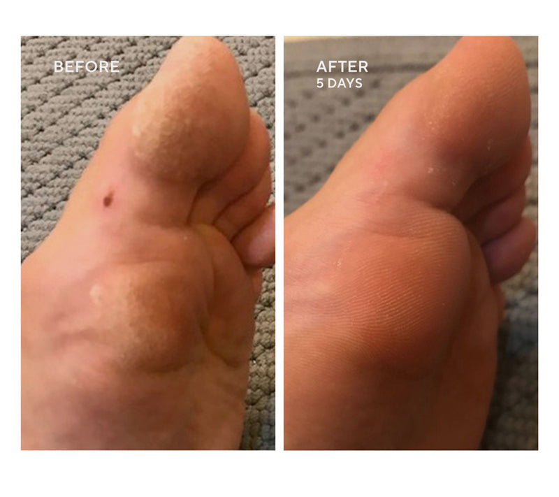 Whish 13oz MEGA Exfoliating Foot Mask — View 5
