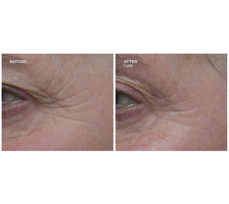 Gatineau Limited Edition Age Benefit Mult-Acid Peel Duo — View 5