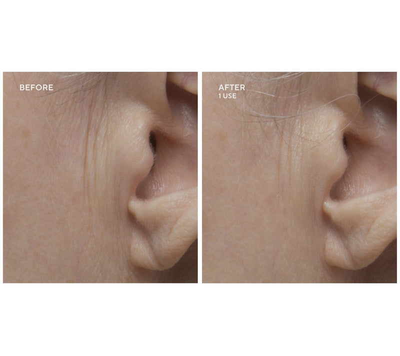 Gatineau Limited Edition Age Benefit Mult-Acid Peel Duo — View 7