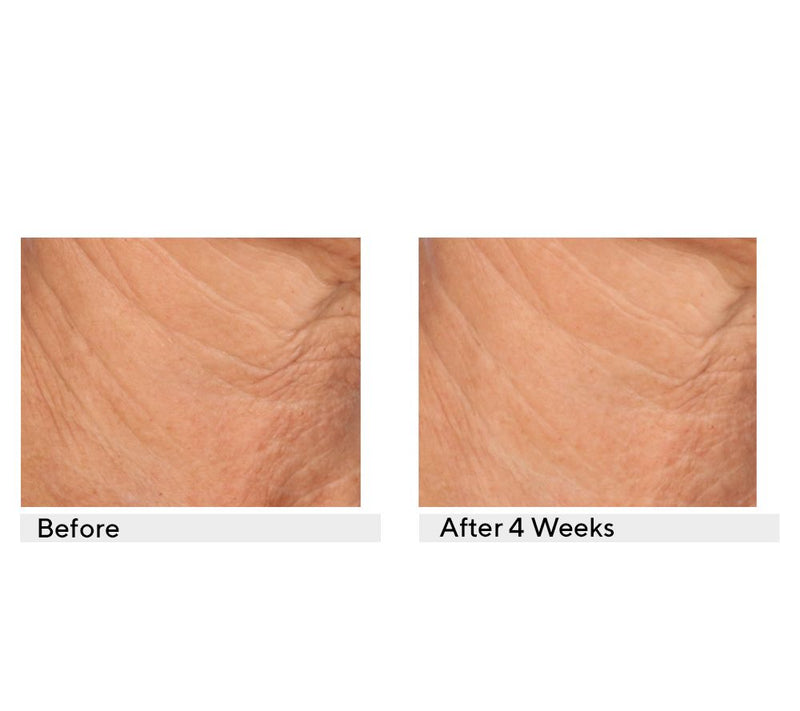 SERIOUS SKINCARE Reverse Lift Correc-Chin In-Tense Cream — View 4