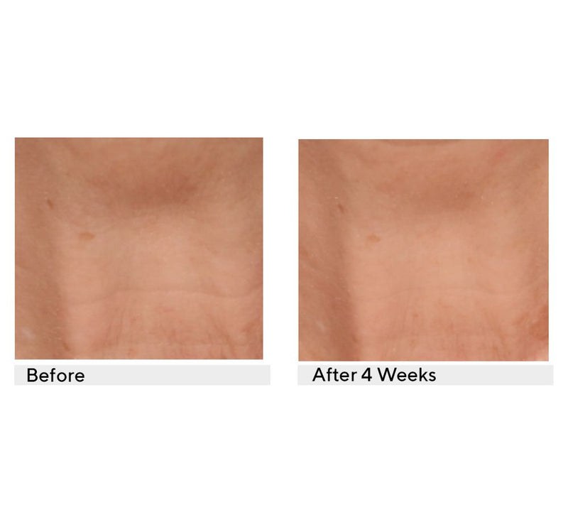 SERIOUS SKINCARE Reverse Lift Correc-Chin In-Tense Cream — View 2