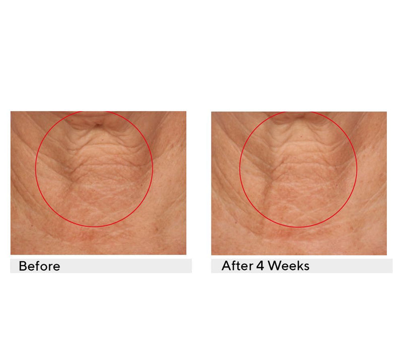 SERIOUS SKINCARE Reverse Lift Correc-Chin In-Tense Cream — View 3