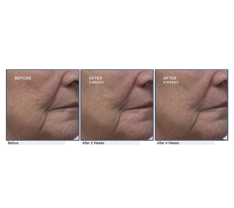 ELEMIS Pro-Collagen Future Restore Serum Duo — View 7