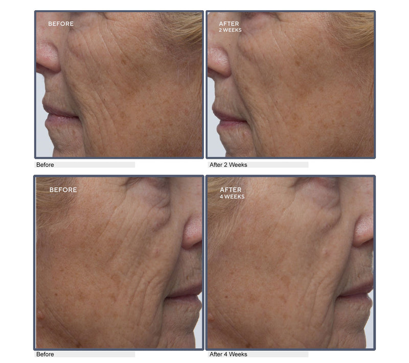ELEMIS Pro-Collagen Future Restore Serum Duo — View 4