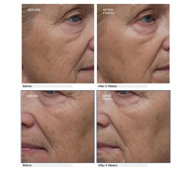 ELEMIS Pro-Collagen Future Restore Serum Duo Auto-Delivery — View 3