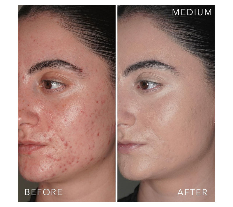 Doll 10 T.C.E Super Coverage Serum Makeup w/ Peptides — View 28