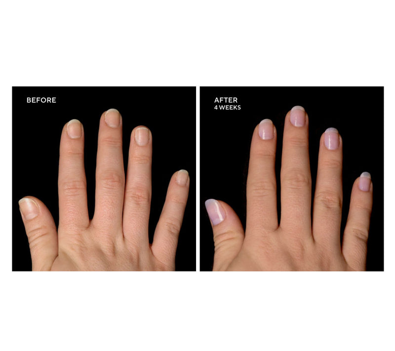 Perfect Formula Gel Coat Treatment & Color Set — View 2