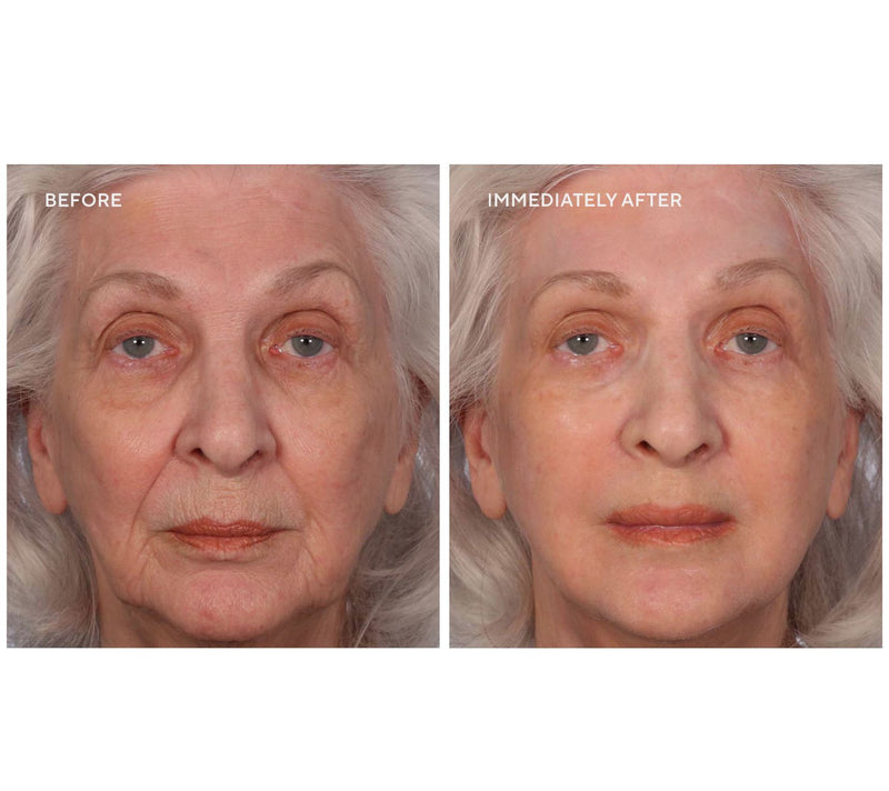 SERIOUS SKINCARE Super-Size Insta-Tox Duo w/Bag — View 6
