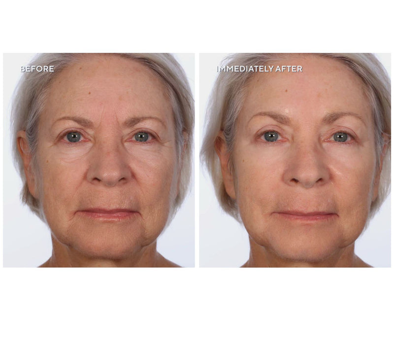 SERIOUS SKINCARE Super-Size Insta-Tox Duo w/Bag — View 2