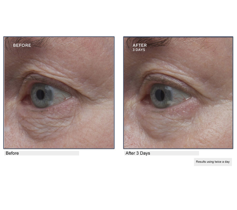 Lancer Gravity Defying Eye Cream Auto-Delivery — View 5