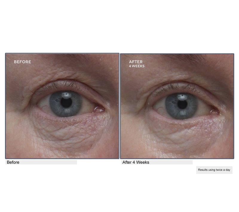 Lancer Gravity Defying Eye Cream Auto-Delivery — View 6