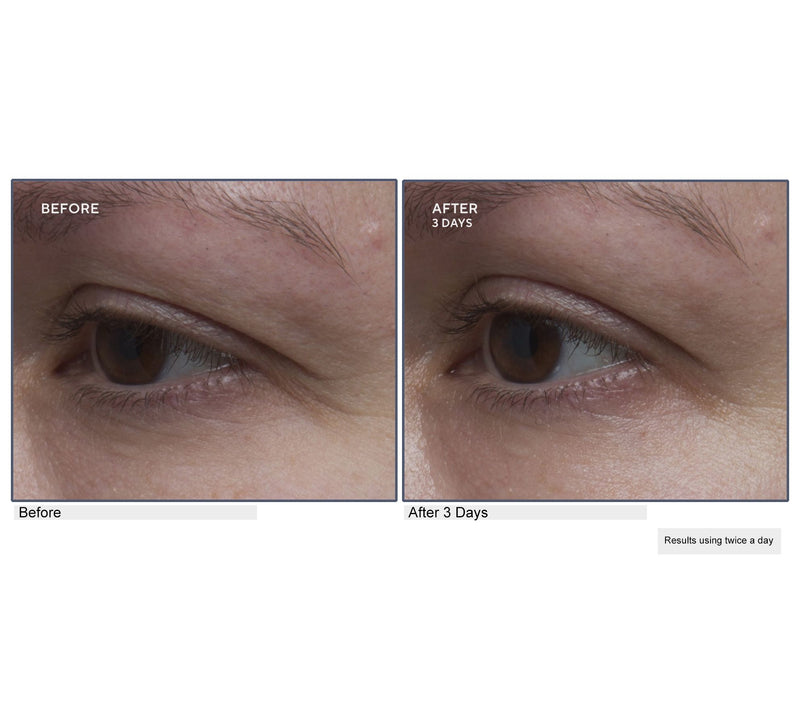Lancer Gravity Defying Eye Cream Auto-Delivery — View 4