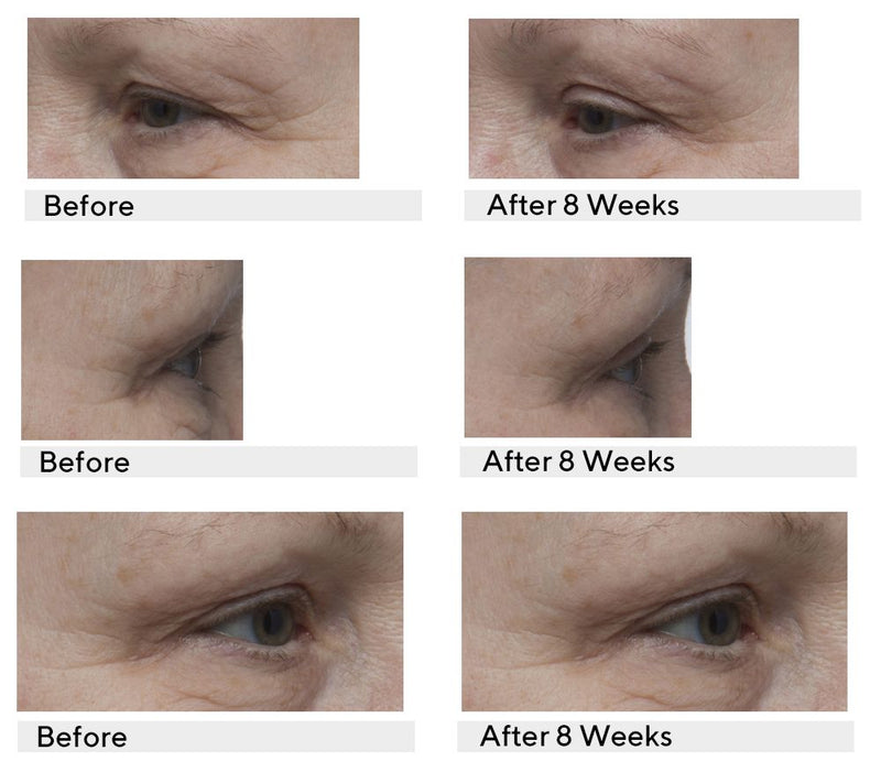 Body Firm Essentials Age Defy Neck & Eye Treatment Set — View 3