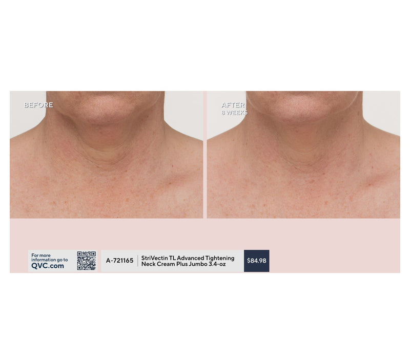 StriVectin TL Advanced Tightening Neck Cream Plus Jumbo 3.4oz — View 5