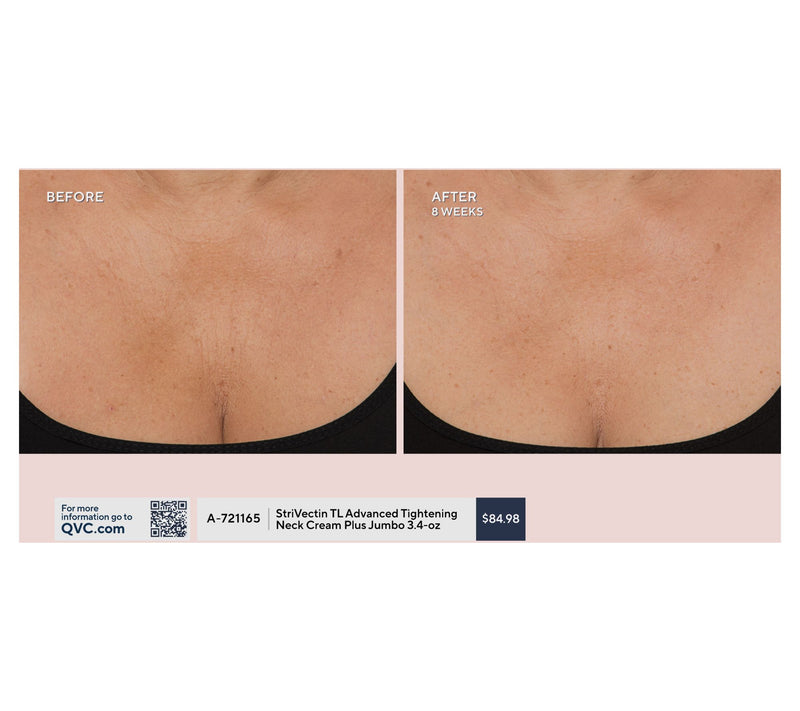 StriVectin TL Advanced Tightening Neck Cream_Plus Auto-Delivery — View 7