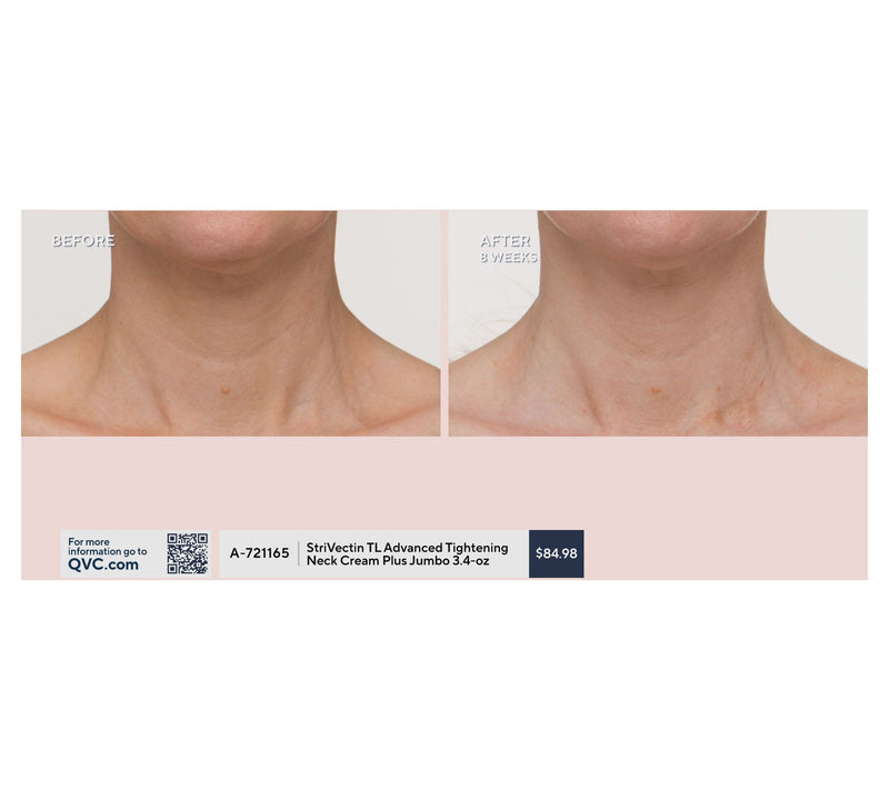 StriVectin TL Advanced Tightening Neck Cream_Plus Auto-Delivery — View 6