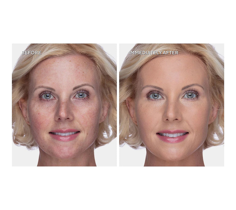 Dr. Denese - SPF 40 Tinted Defense Day Cream — View 7