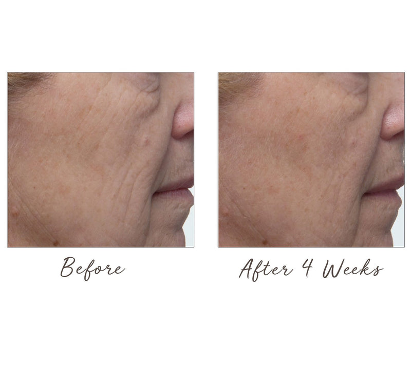 ELEMIS Pro-Collagen Overnight Matrix & Renewal Serum — View 5