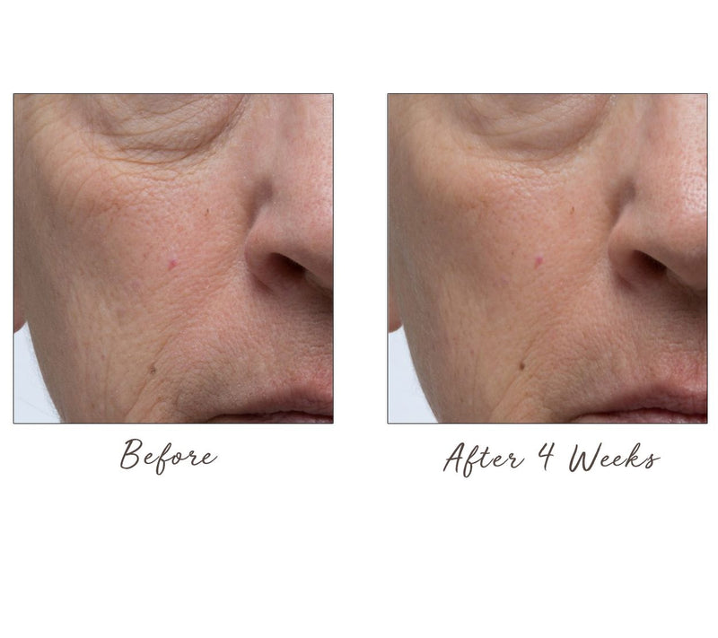 ELEMIS Pro-Collagen Overnight Matrix & Renewal Serum — View 4