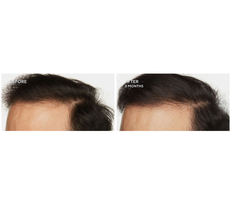 WEN by Chaz Dean Re-Moist Mask Duo + 3.4oz Botanical Tonic — View 16