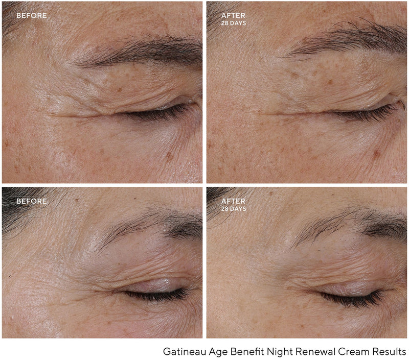 Gatineau Age Benefit Night Renewal Cream & Night Elixir — View 5