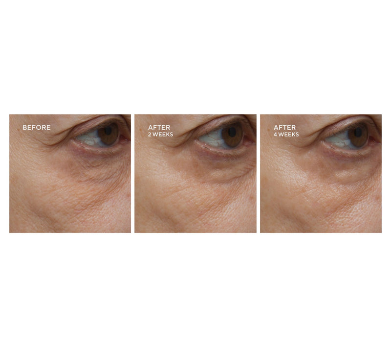 Perricone MD Super Size High Potency Face Firming Moisturizer — View 4