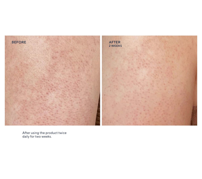 First Aid Beauty Ultra Repair Cream 14oz + 8oz Duo w/ Mini KP — View 7