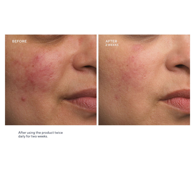 First Aid Beauty Ultra Repair Cream 14oz + 8oz Duo w/ Mini KP — View 4